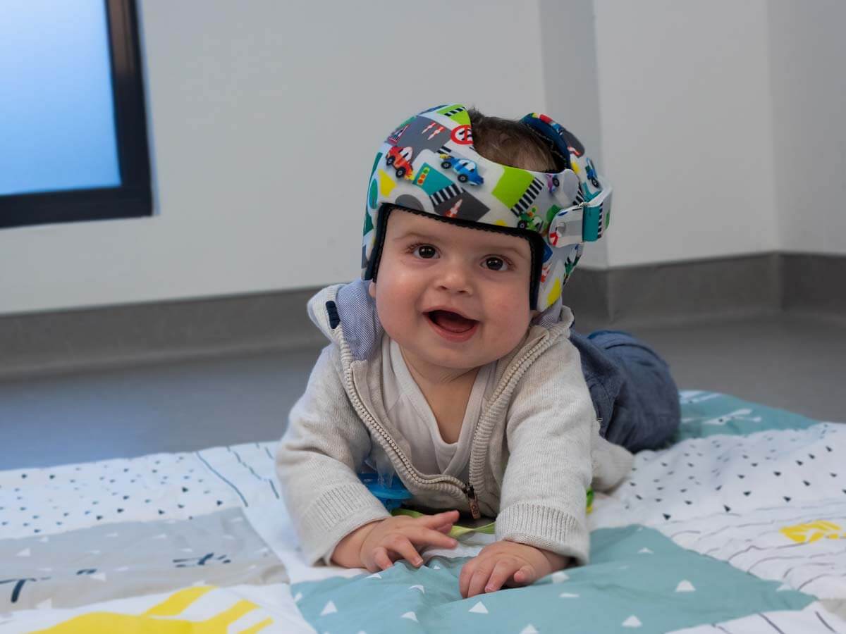 Un bébé porte un casque plagiocéphalique parfaitement ajusté